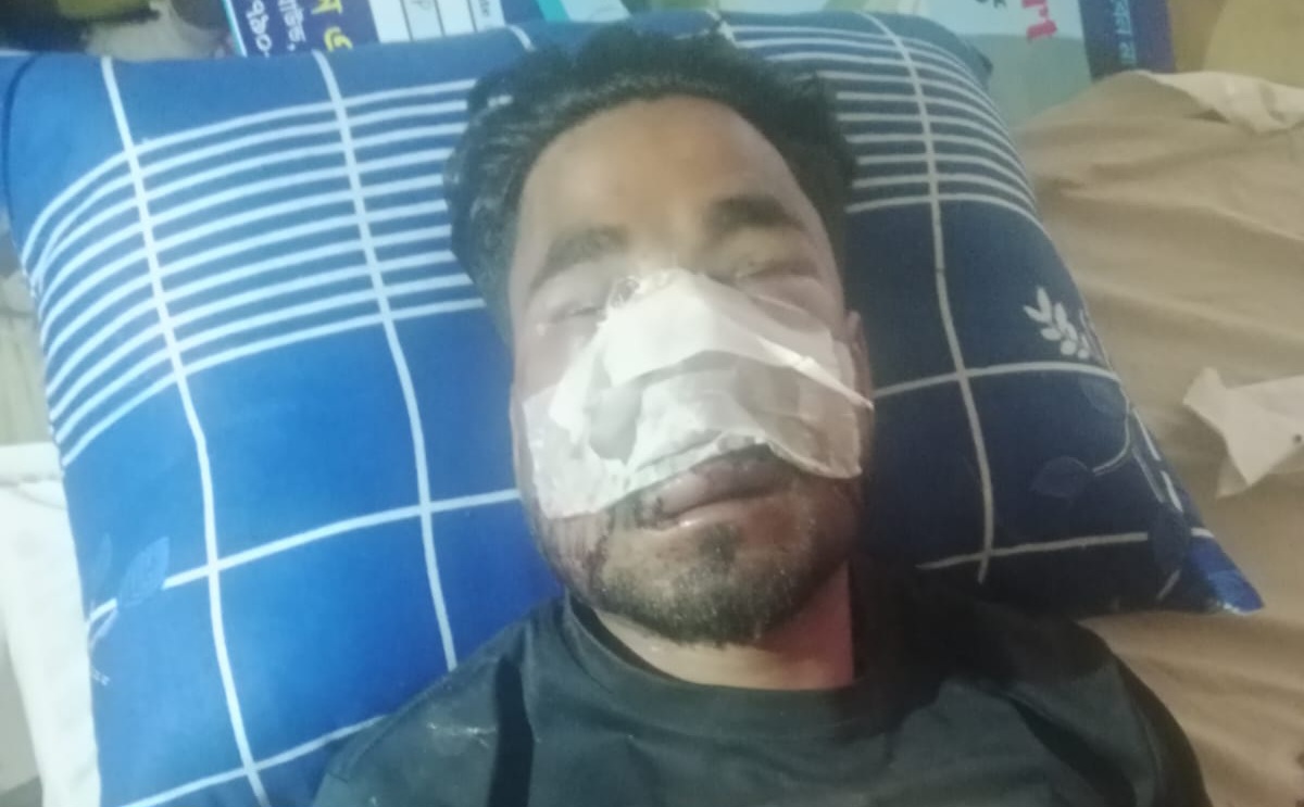 ব্রাহ্মণবাড়িয়া বিজয়নগরে জলাশয় দখল বেদখল নিয়ে আনোয়ার নামে ব্যক্তিকে পিটিয়ে গুরুতর আহত থানায় মামলা