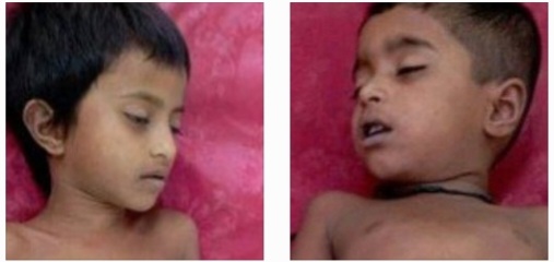 নীলফামারীতে বিদ্যুৎতায়িত ঘরে শক লেগে ২ শিশুর মৃত্যু