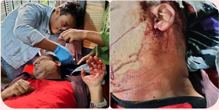 বুড়িচংয়ে জানাযার নামাজে প্রতিপক্ষের হামলায় সাংবাদিকসহ আহত ১ জন