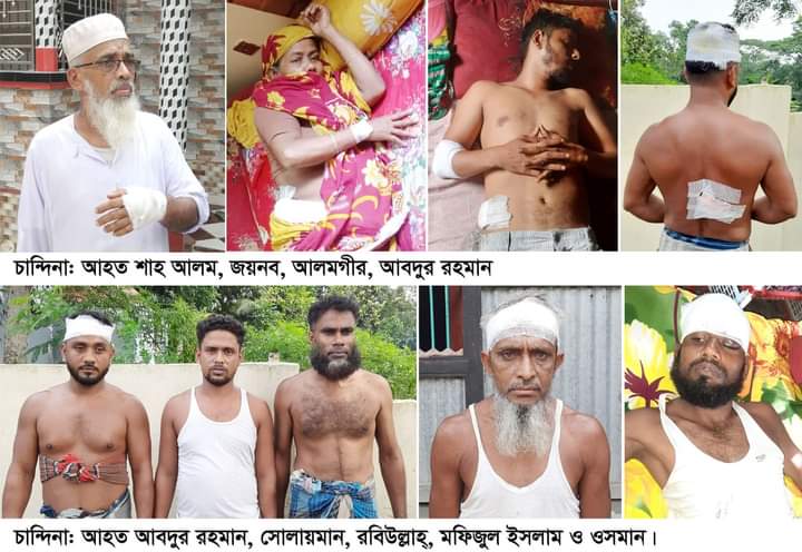 চান্দিনায় ভয়াবহ রাত কাটালো বড়ইয়া কৃষ্ণপুর গ্রামবাসী ডাকাতের কুপে আহত ১১ জন