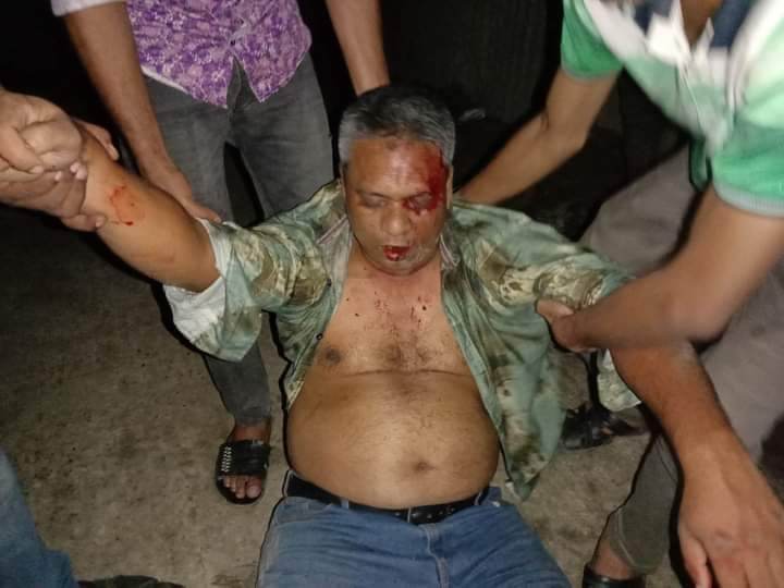 সাংবাদিক হত্যার দ্রুত বিচারে ফাঁসি চাই।