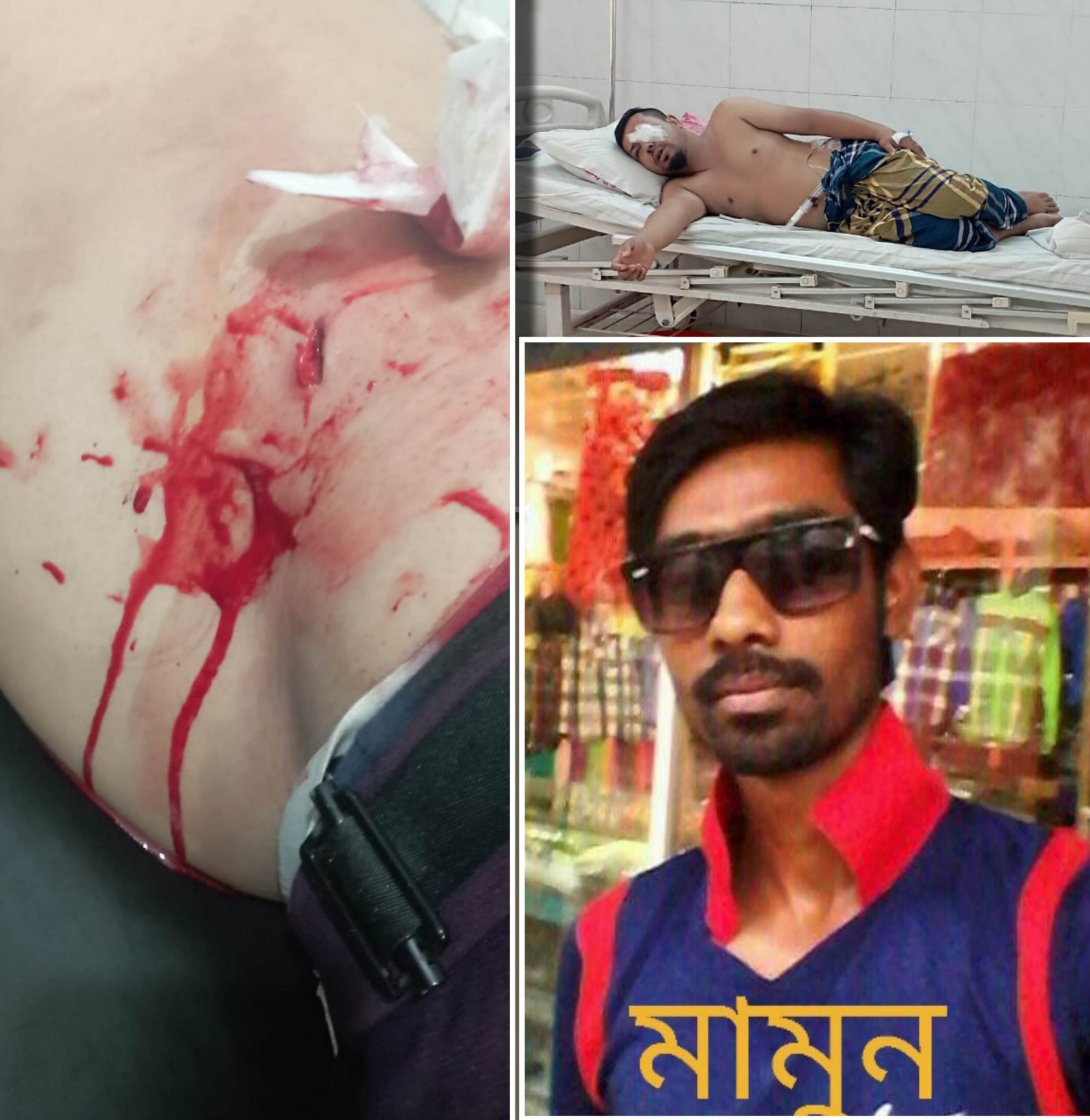 পলাশে যুবলীগ নেতাকে ছুরিকাঘাতে হত্যার চেস্টা