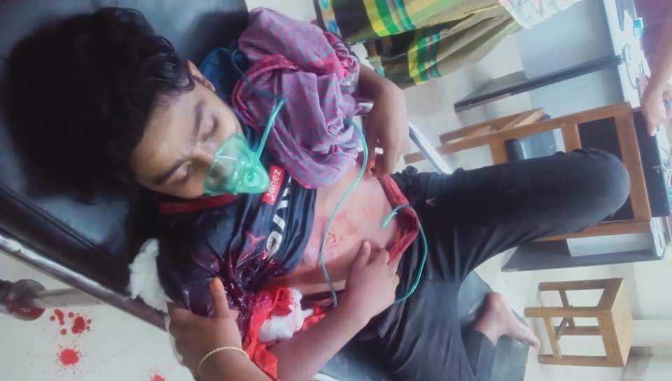 নবীনগরের বাড্ডা গ্রামে তুচ্ছ ঘটনাকে কেন্দ্র করে সংঘর্ষে নিহত -১ আহত- ২